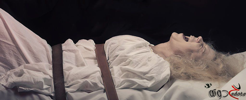 تفسير رؤية الشلل في المنام