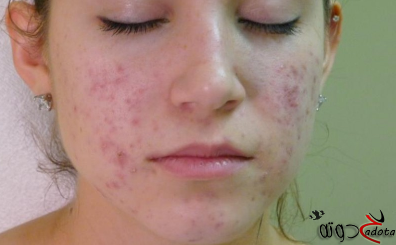 تفسير رؤية تشوه الوجه في المنام