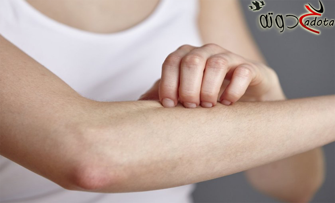 ما تفسير المرض الجلدي في المنام