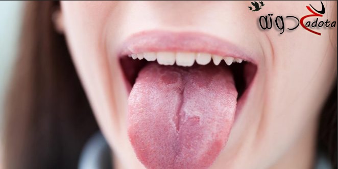 تفسير حلم رؤية اللسان المقطوع في المنام