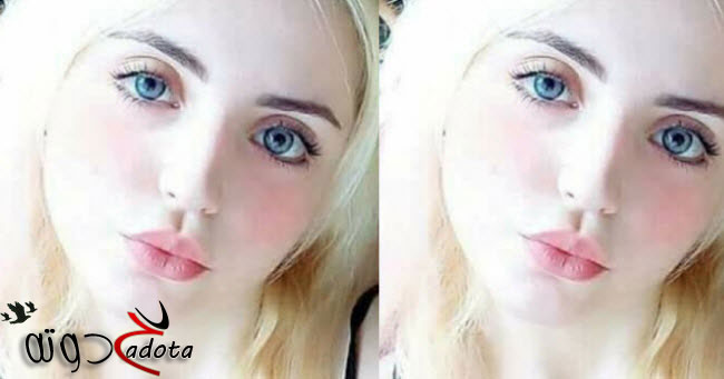 تفسير رؤية بياض الجسم في المنام