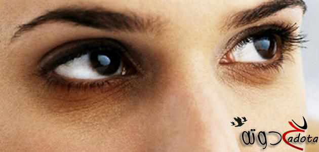 تفسير حلم السواد تحت العينين في المنام