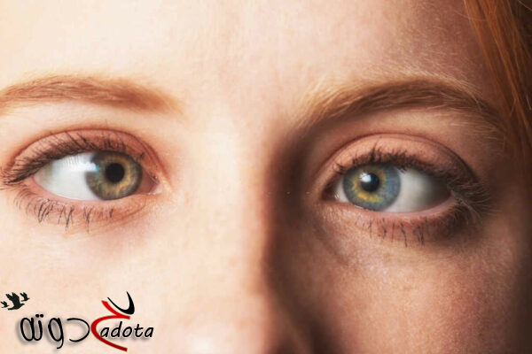 تفسير حلم حول العين في المنام