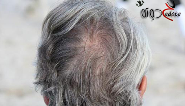 تفسير رؤية زوجي شعره أبيض في المنام