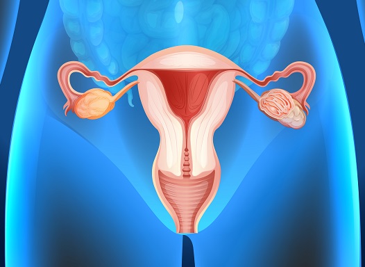 تفسير حلم استئصال الرحم في المنام