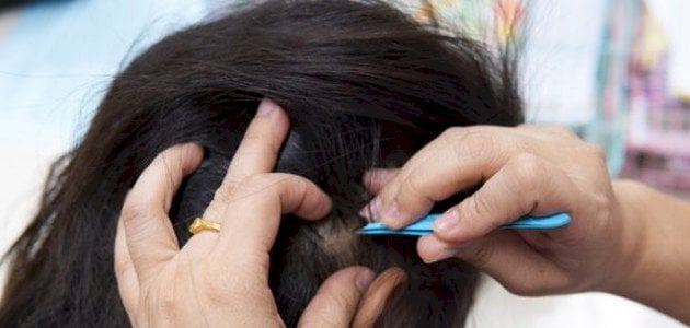 ما هو تفسير رؤية نتف شعر الرأس في الحلم