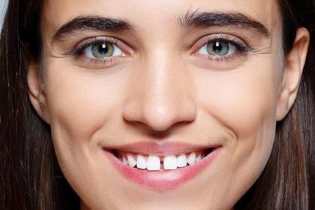 تفسير رؤية فَلجة الأسنان في المنام