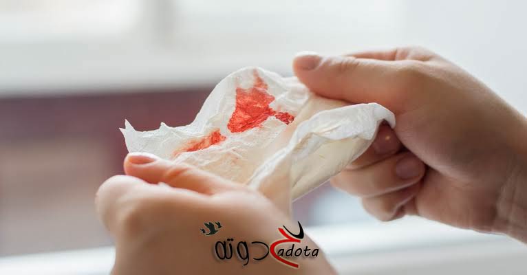 تفسير حلم رؤية الميت ينزف دم من رأسه في المنام