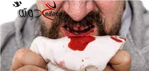 تفسير حلم رؤية خروج دم من فم أبي في المنام